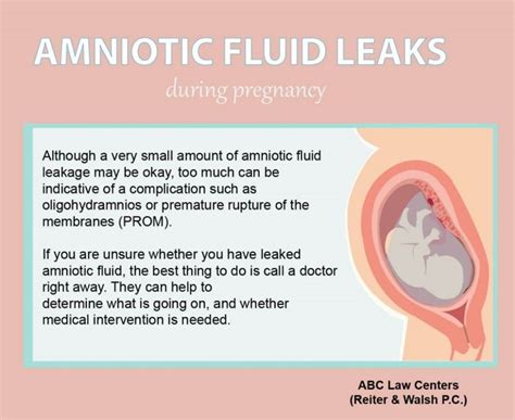 small amount of amniotic fluid leak|3 Ways to Identify an Amniotic Fluid Leak